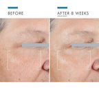 SkinCeuticals A.G.E. Advanced Eye for Dark Circles