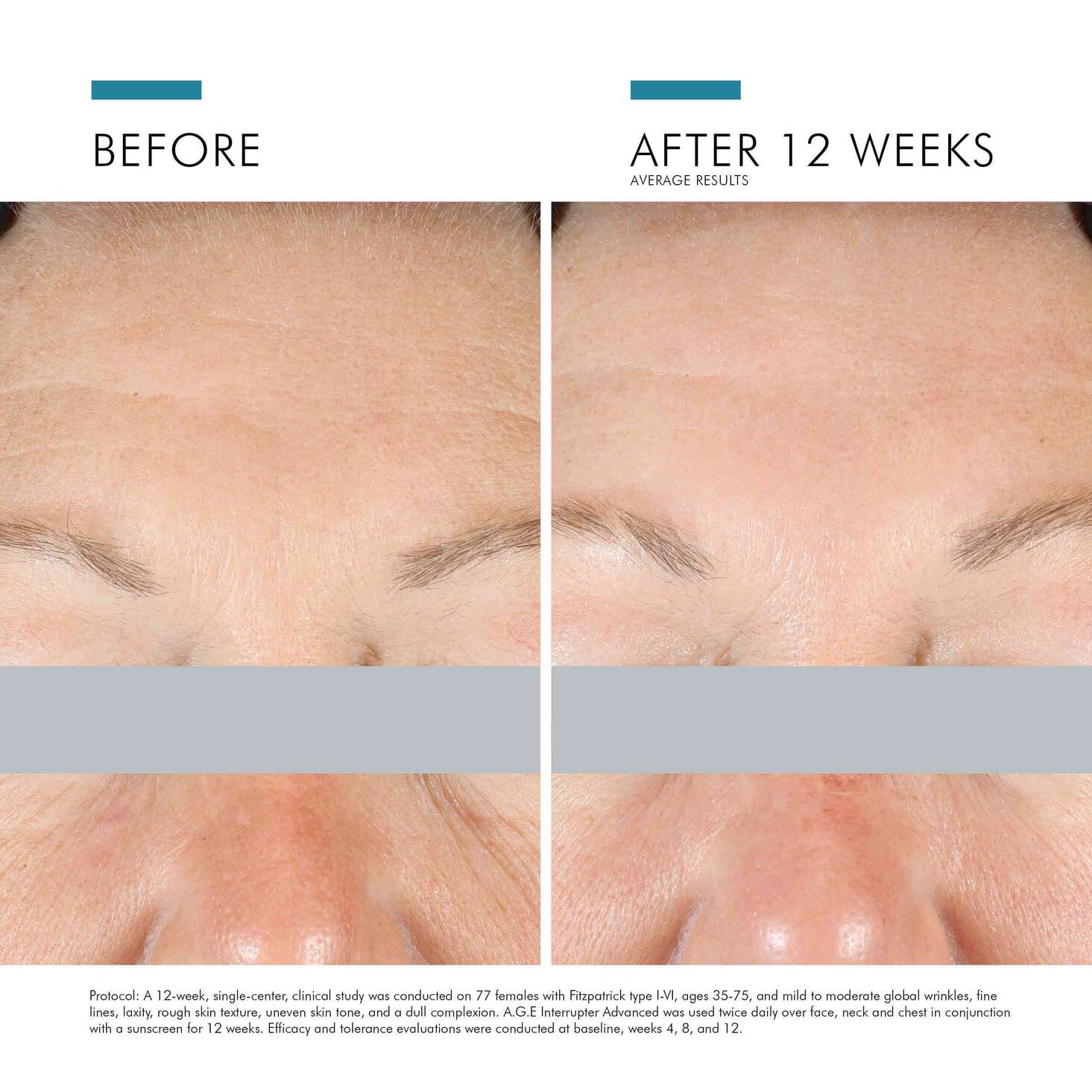 SkinCeuticals A.G.E. Interrupter Advanced Cream