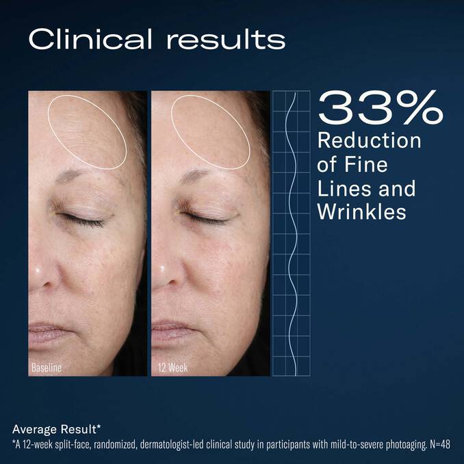 Clinical results show 33% reduction in fine lines and wrinkles after 12 weeks - Vos Collection