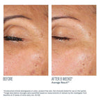 SkinBetter Science EyeMax AlphaRet Overnight Cream
