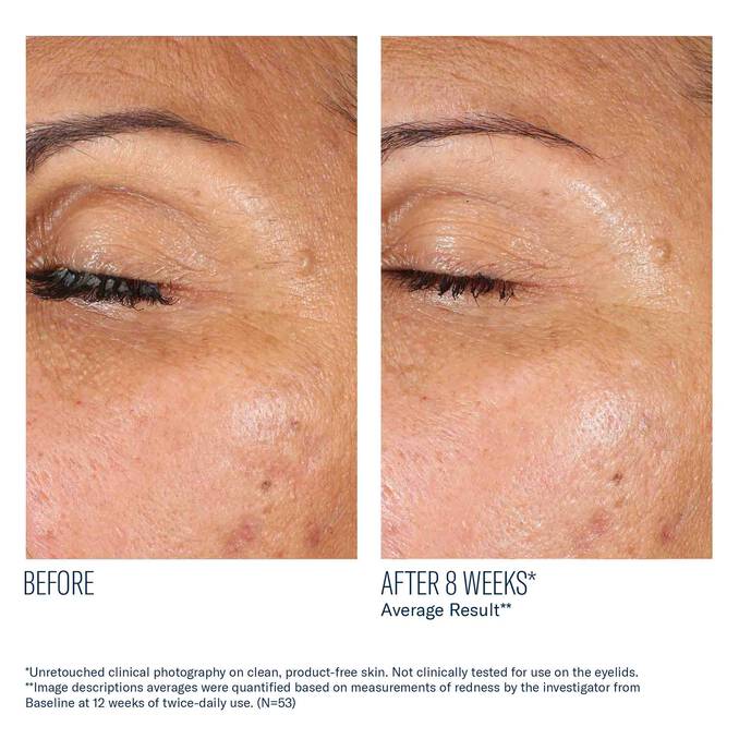 SkinBetter Science EyeMax AlphaRet Overnight Cream