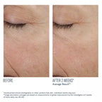 Skinbetter Science Trio Rebalancing Moisture Treatment