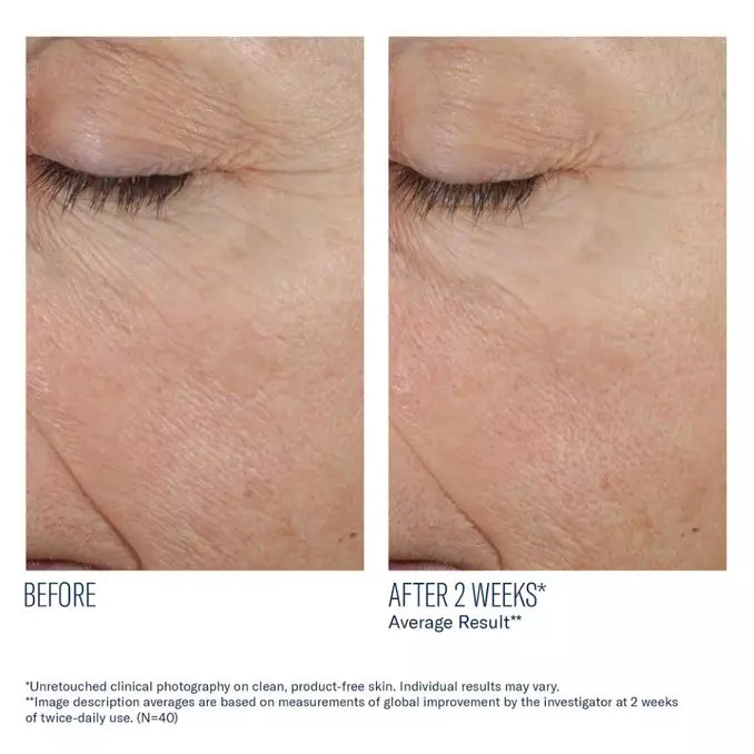 Skinbetter Science Trio Rebalancing Moisture Treatment