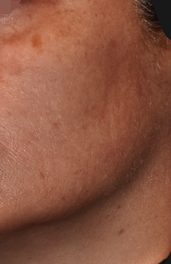 SkinCeuticals Pigment Regulator helps fade dark spots and uneven tone - Vos Collection
