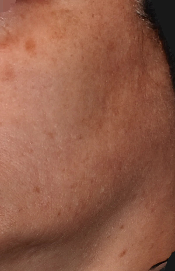 SkinCeuticals Correct Pigment Regulator helps fade dark spots & evens skin tone - Vos Collection